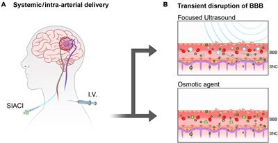 Overcoming challenges in glioblastoma treatment: targeting infiltrating cancer cells and harnessing the tumor microenvironment